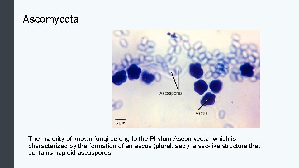 Ascomycota The majority of known fungi belong to the Phylum Ascomycota, which is characterized