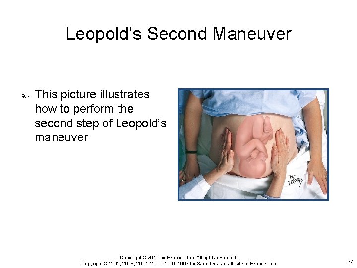 Leopold’s Second Maneuver This picture illustrates how to perform the second step of Leopold’s