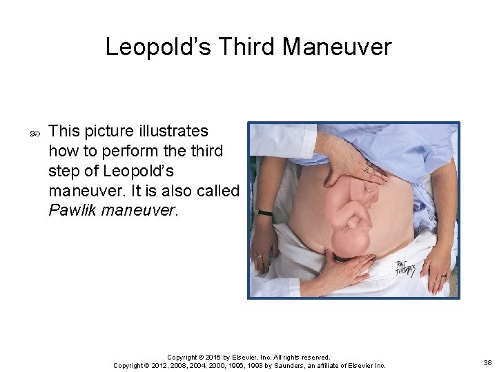 Leopold’s Third Maneuver This picture illustrates how to perform the third step of Leopold’s