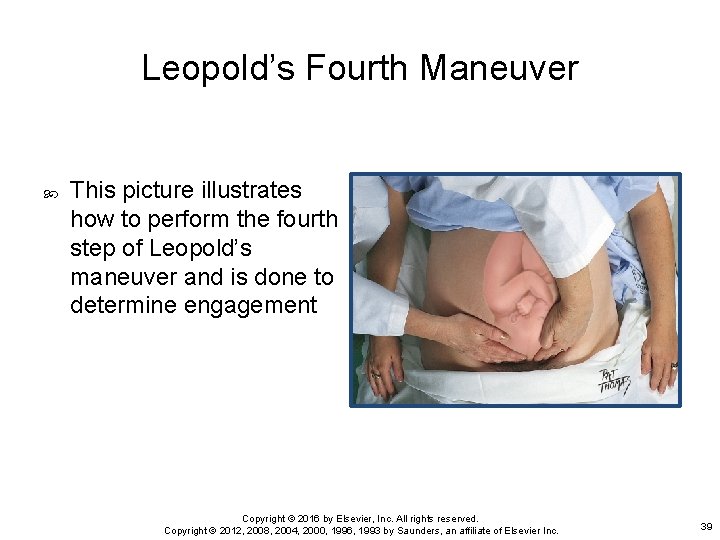 Leopold’s Fourth Maneuver This picture illustrates how to perform the fourth step of Leopold’s