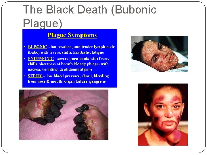 The Black Death (Bubonic Plague) 