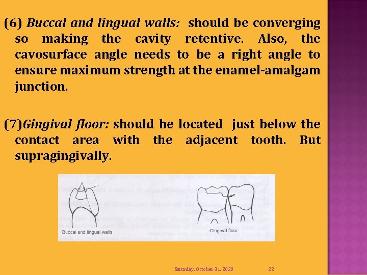 (6) Buccal and lingual walls: should be converging so making the cavity retentive. Also,