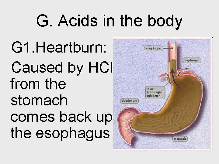 G. Acids in the body G 1. Heartburn: Caused by HCl from the stomach