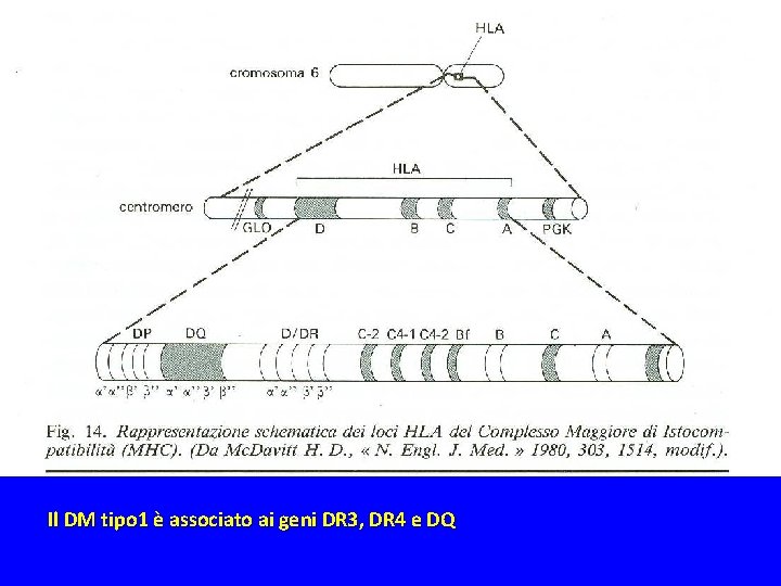 Il DM tipo 1 è associato ai geni DR 3, DR 4 e DQ