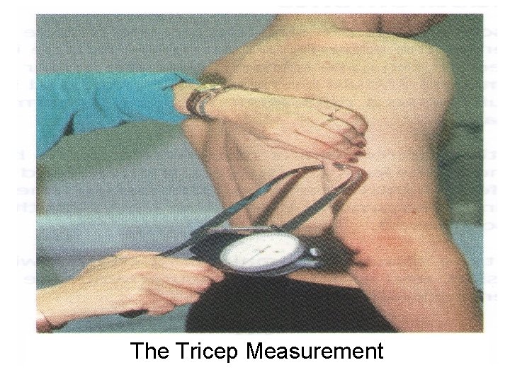 The Tricep Measurement 