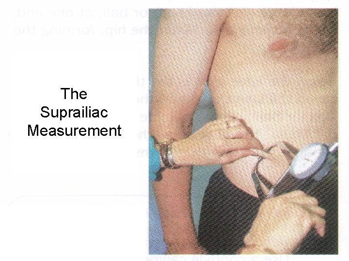 The Suprailiac Measurement 