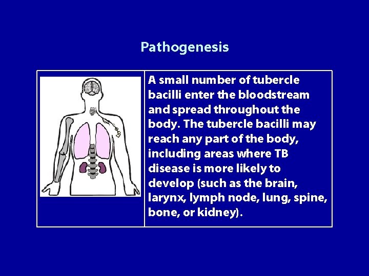 Pathogenesis A small number of tubercle bacilli enter the bloodstream and spread throughout the