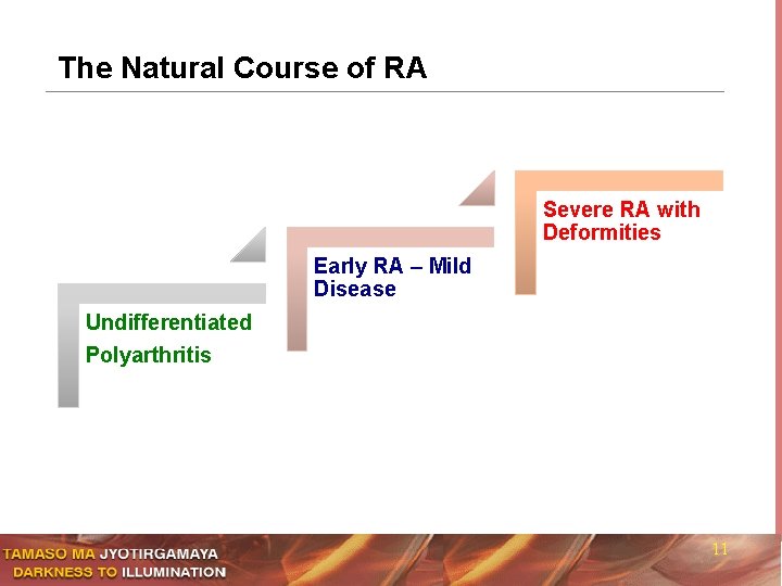 The Natural Course of RA Severe RA with Deformities Early RA – Mild Disease