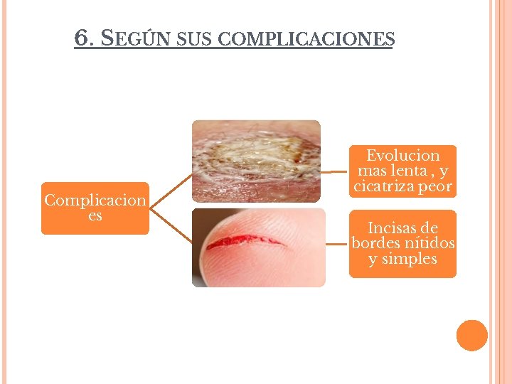 6. SEGÚN SUS COMPLICACIONES Herida infectada Evolucion mas lenta , y cicatriza peor Herida