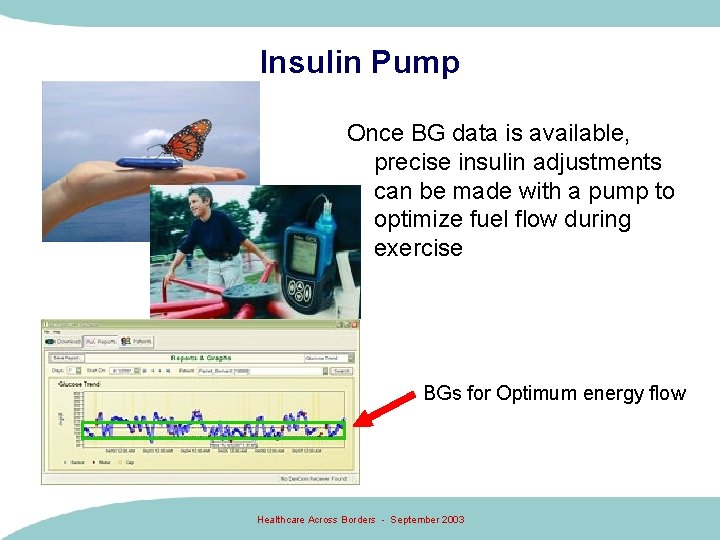 Insulin Pump Once BG data is available, precise insulin adjustments can be made with