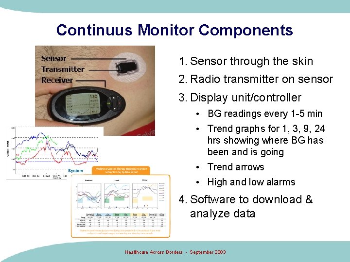 Continuus Monitor Components 1. Sensor through the skin 2. Radio transmitter on sensor 3.