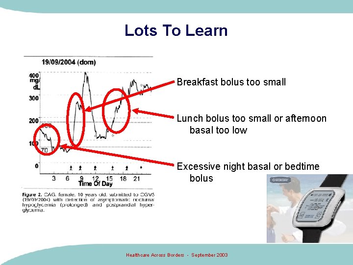 Lots To Learn Breakfast bolus too small Lunch bolus too small or afternoon basal