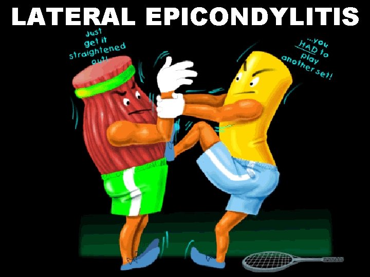 LATERAL EPICONDYLITIS 