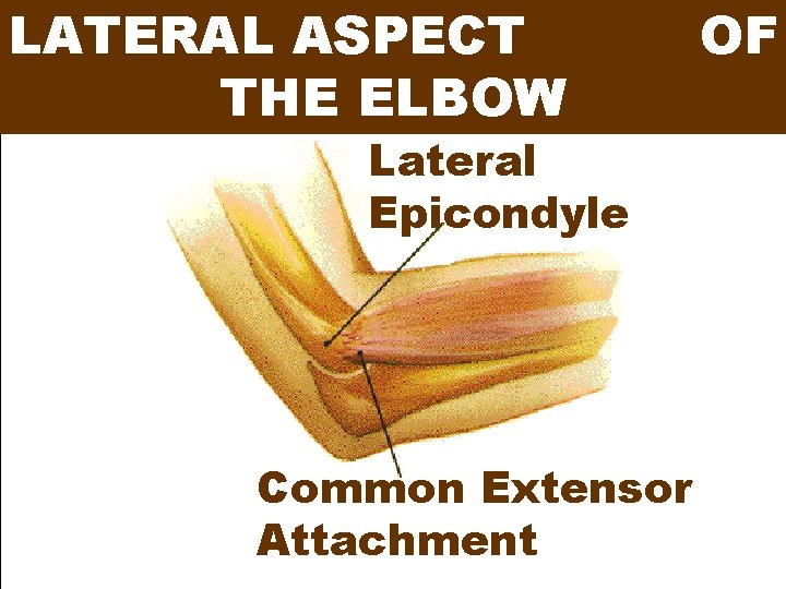 LATERAL ASPECT THE ELBOW Lateral Epicondyle Common Extensor Attachment OF 