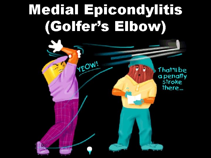 Medial Epicondylitis (Golfer’s Elbow) 