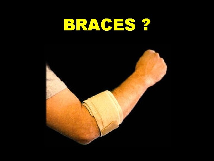 BRACES ? 