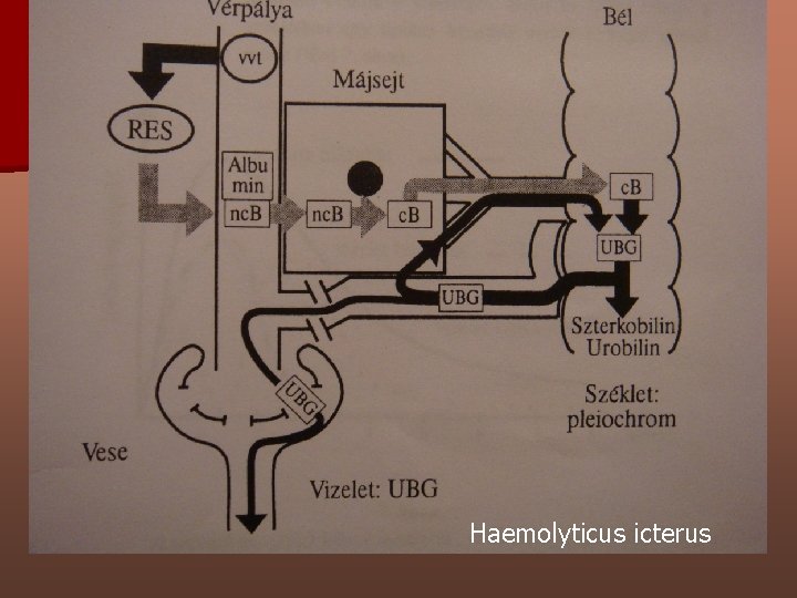 Haemolyticus icterus 