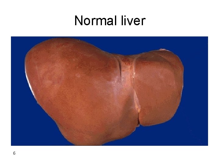 Normal liver 6 