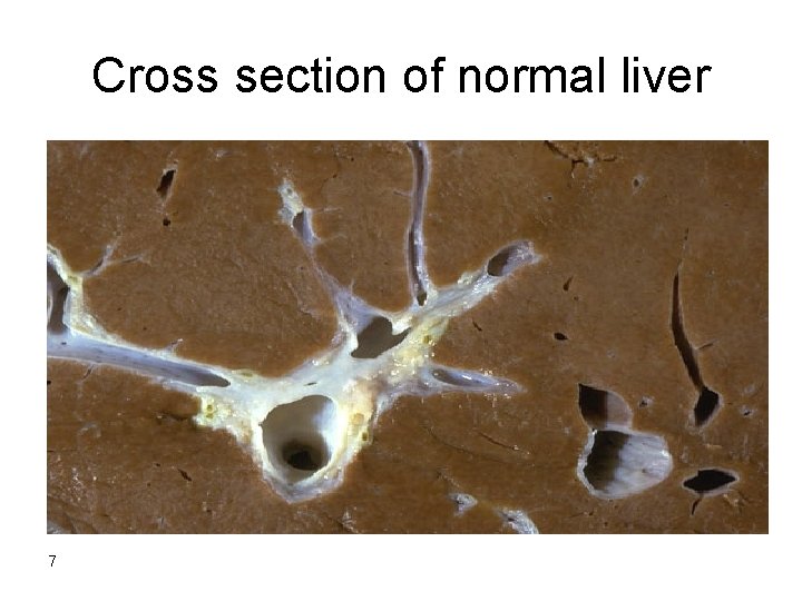 Cross section of normal liver 7 