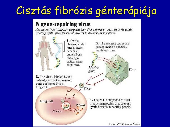 Cisztás fibrózis génterápiája 