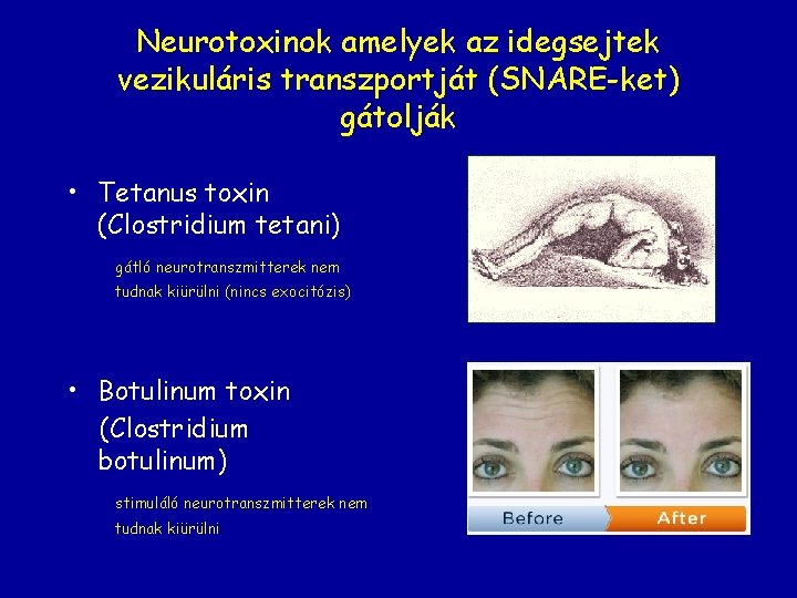 Neurotoxinok amelyek az idegsejtek vezikuláris transzportját (SNARE-ket) gátolják • Tetanus toxin (Clostridium tetani) gátló