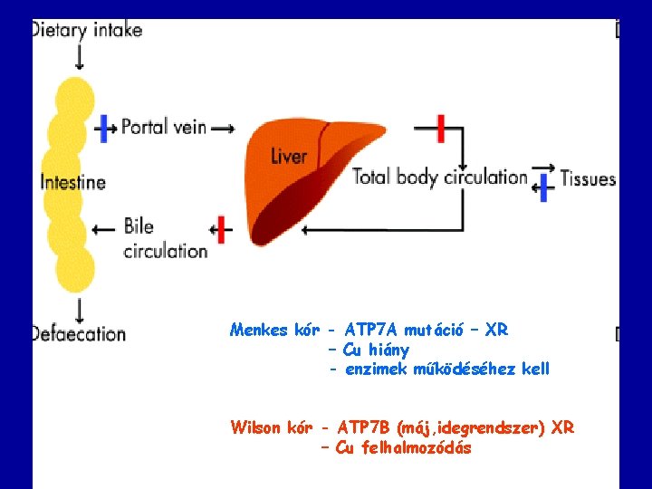 Menkes kór - ATP 7 A mutáció – XR – Cu hiány - enzimek
