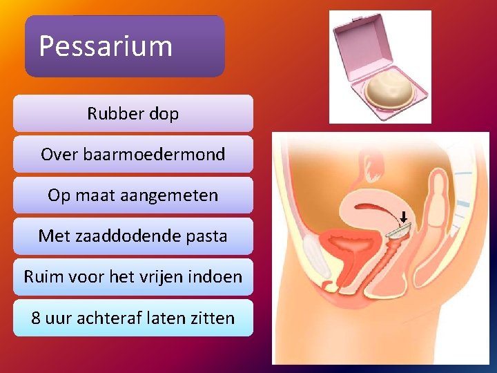 Pessarium Rubber dop Over baarmoedermond Op maat aangemeten Met zaaddodende pasta Ruim voor het