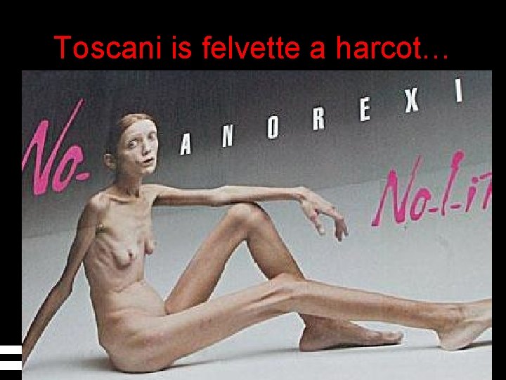 Toscani is felvette a harcot… 