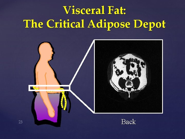 Visceral Fat: The Critical Adipose Depot 23 Back 