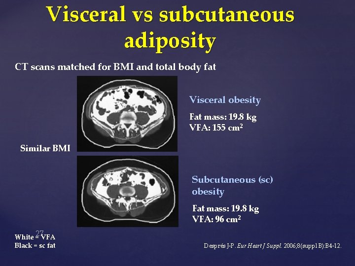 Visceral vs subcutaneous adiposity CT scans matched for BMI and total body fat Visceral