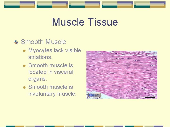 Muscle Tissue Smooth Muscle l l l Myocytes lack visible striations. Smooth muscle is