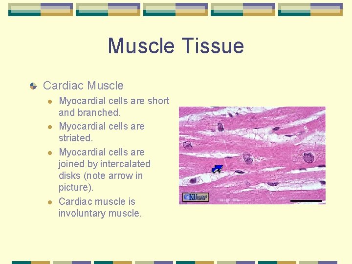 Muscle Tissue Cardiac Muscle l l Myocardial cells are short and branched. Myocardial cells
