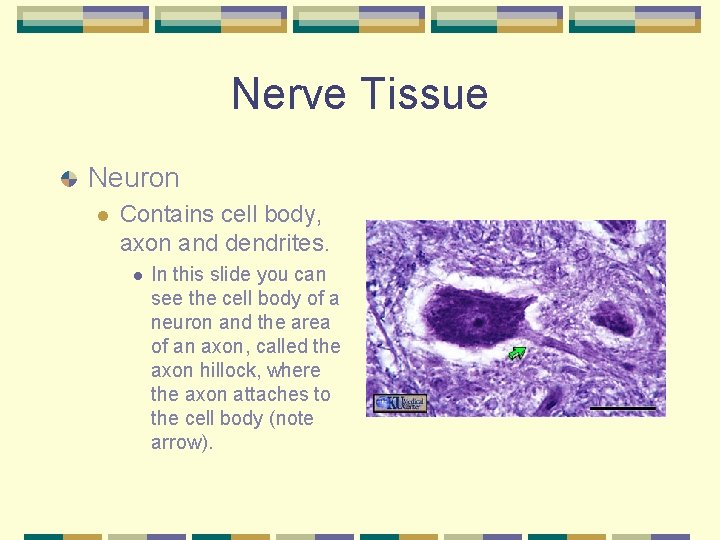 Nerve Tissue Neuron l Contains cell body, axon and dendrites. l In this slide