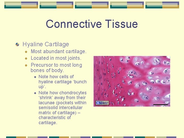Connective Tissue Hyaline Cartilage l l l Most abundant cartilage. Located in most joints.