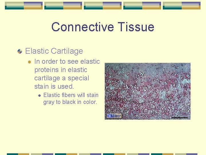 Connective Tissue Elastic Cartilage l In order to see elastic proteins in elastic cartilage