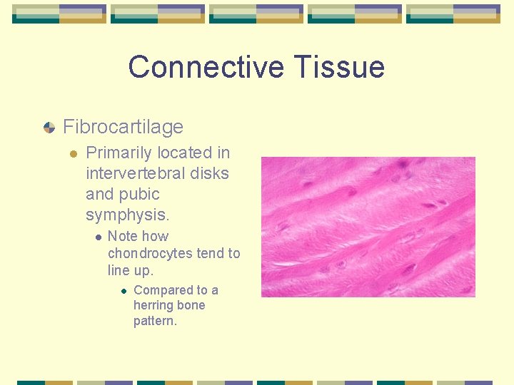 Connective Tissue Fibrocartilage l Primarily located in intervertebral disks and pubic symphysis. l Note