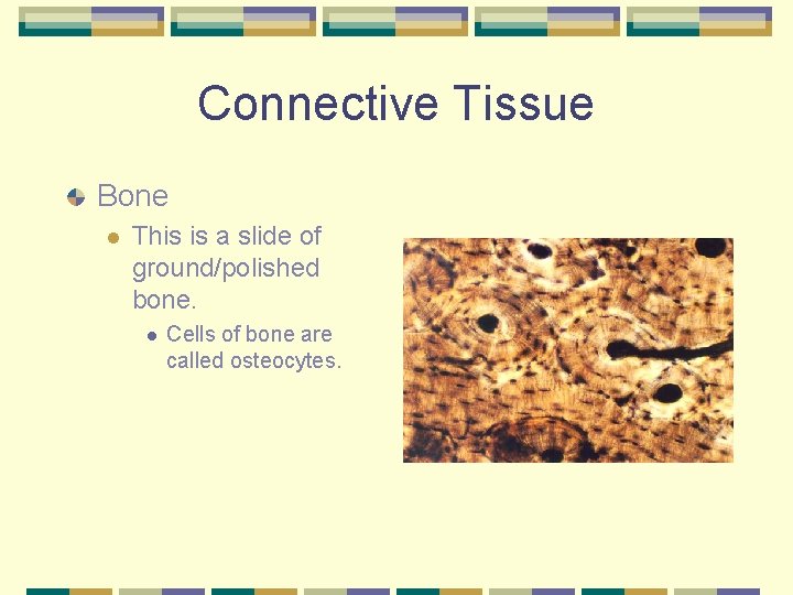 Connective Tissue Bone l This is a slide of ground/polished bone. l Cells of
