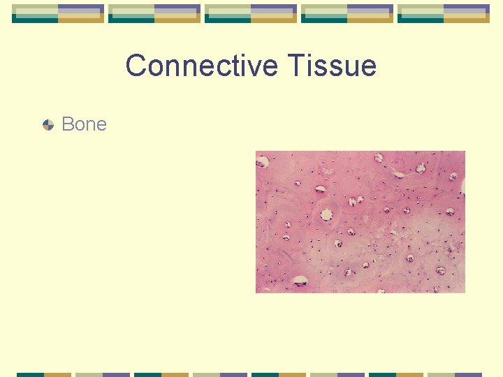 Connective Tissue Bone 