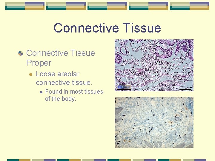 Connective Tissue Proper l Loose areolar connective tissue. l Found in most tissues of
