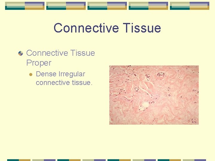 Connective Tissue Proper l Dense Irregular connective tissue. 