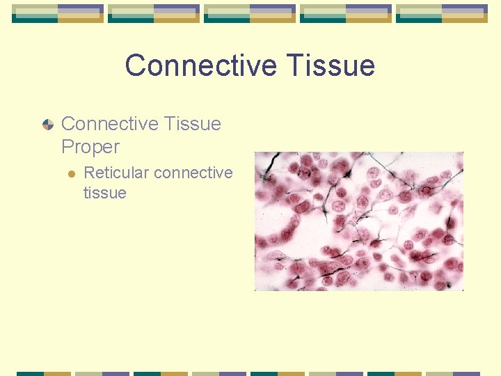 Connective Tissue Proper l Reticular connective tissue 