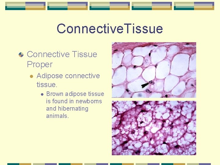 Connective. Tissue Connective Tissue Proper l Adipose connective tissue. l Brown adipose tissue is
