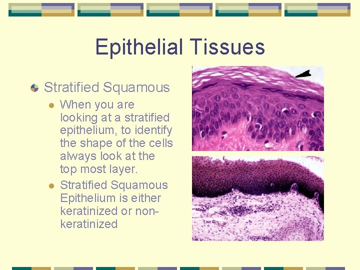 Epithelial Tissues Stratified Squamous l l When you are looking at a stratified epithelium,
