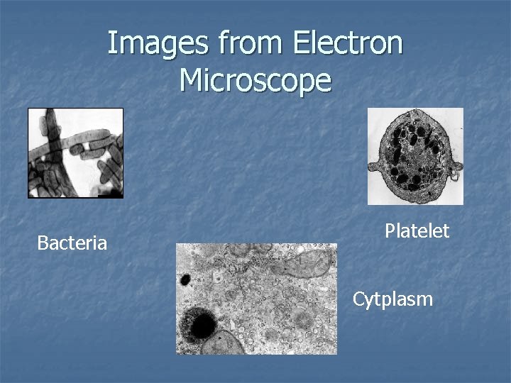 Images from Electron Microscope Bacteria Platelet Cytplasm 