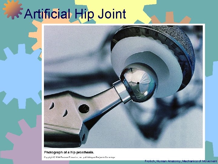 Artificial Hip Joint Frolich, Human Anatomy, Mechanics of Movement 