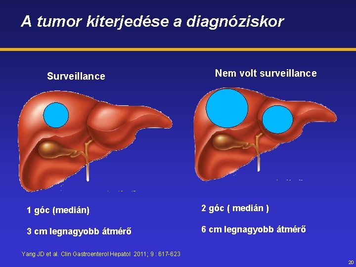 A tumor kiterjedése a diagnóziskor Surveillance Nem volt surveillance 1 góc (medián) 2 góc