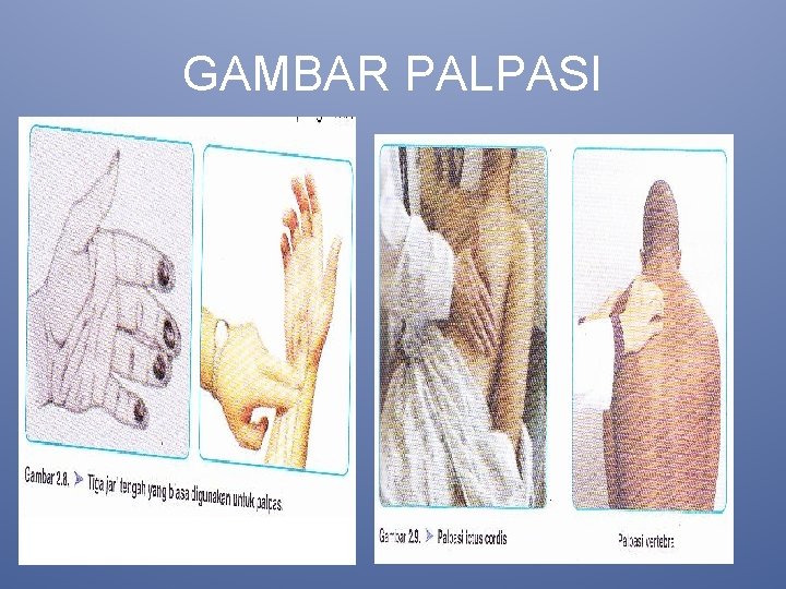 GAMBAR PALPASI 