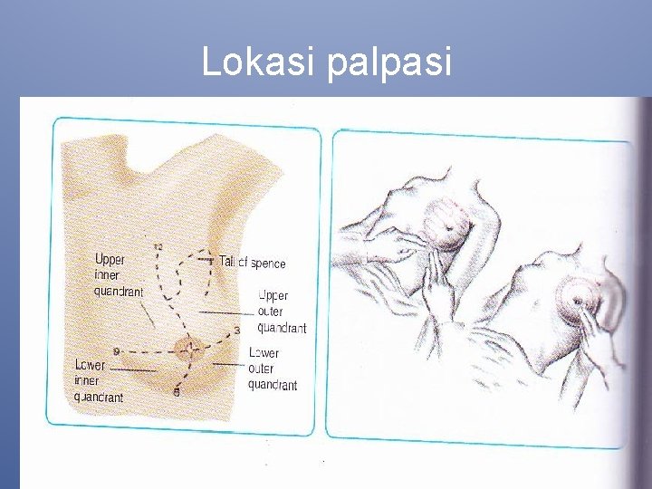 Lokasi palpasi 