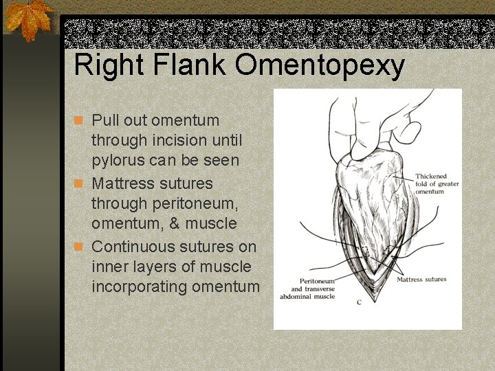 Right Flank Omentopexy n Pull out omentum through incision until pylorus can be seen