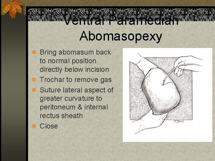 Ventral Paramedian Abomasopexy n Bring abomasum back to normal position directly below incision n